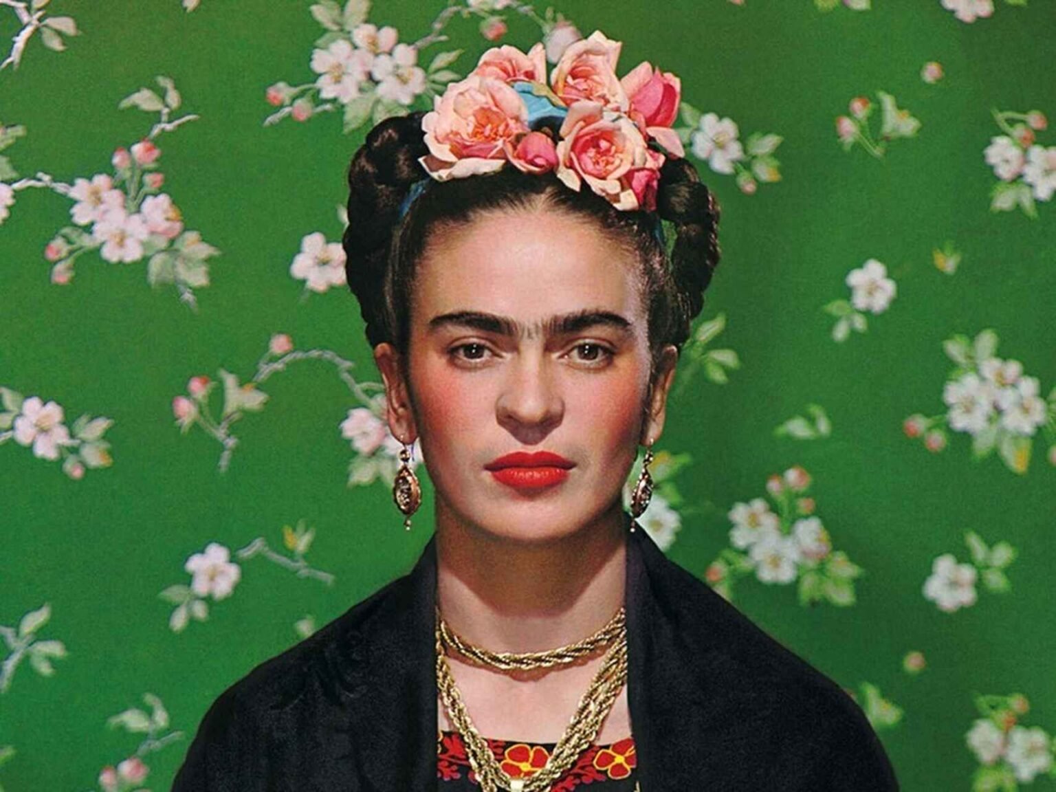Frida Kahlo diagnosticada con síndrome de cola de caballo, 70 años después